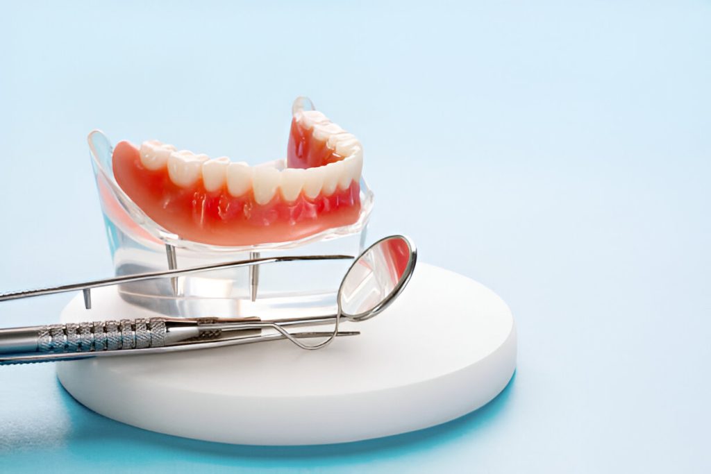 Implant specialist in Mohali