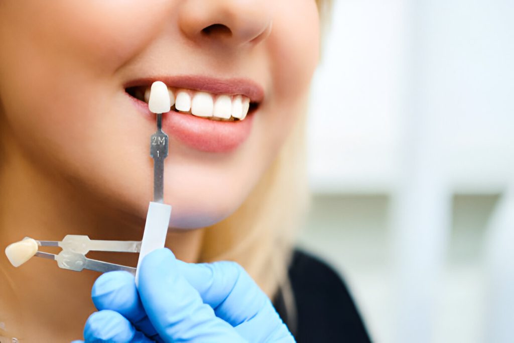 Implant specialist in Mohali