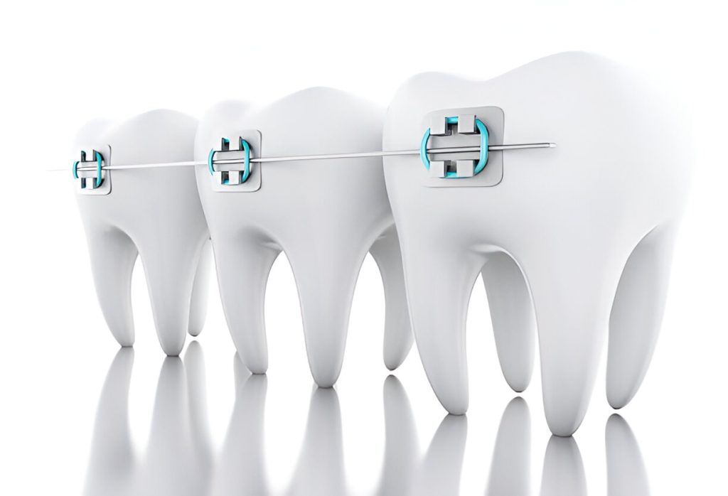 Braces doctor in Mohali