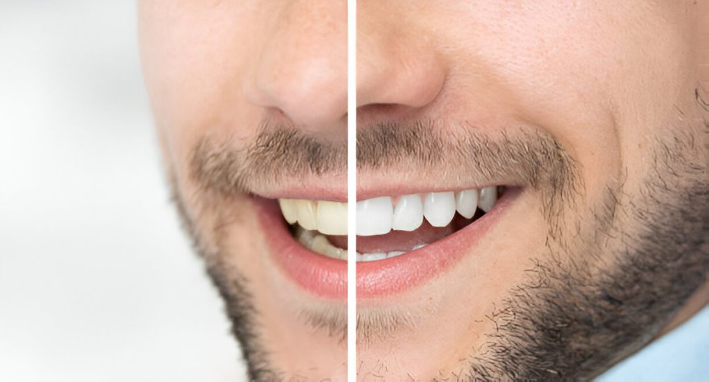 Best dental clinic in phase 11 Mohali