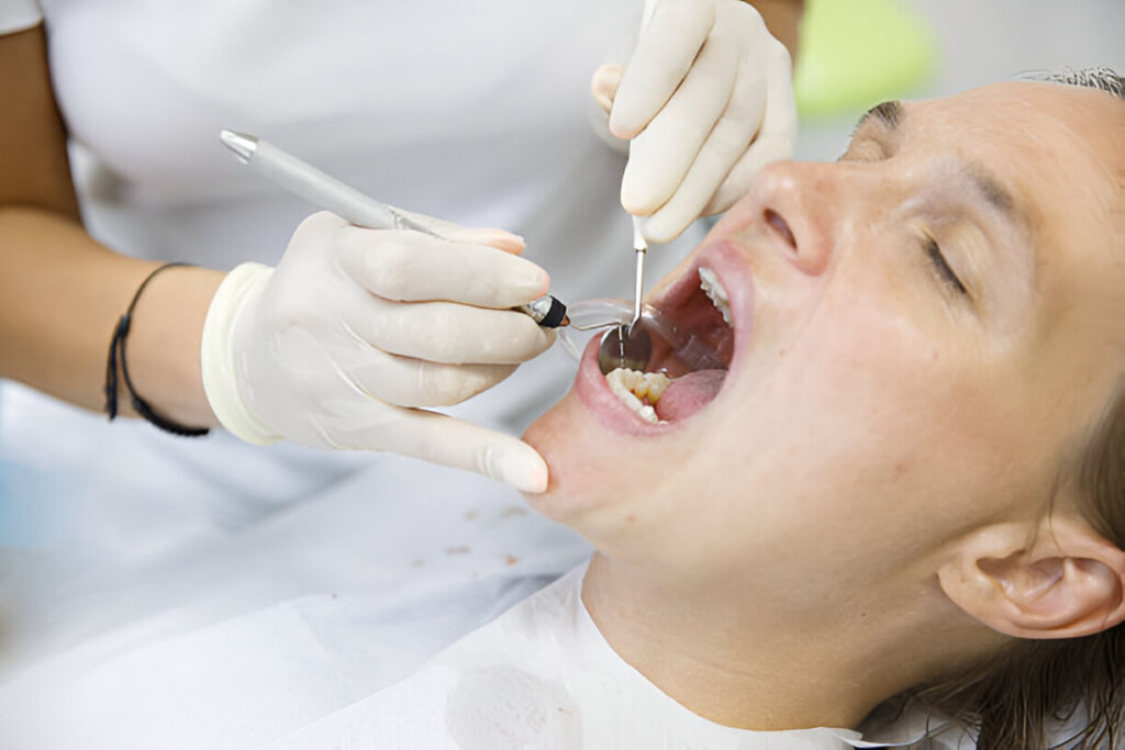 Root canal specialist in Mohali