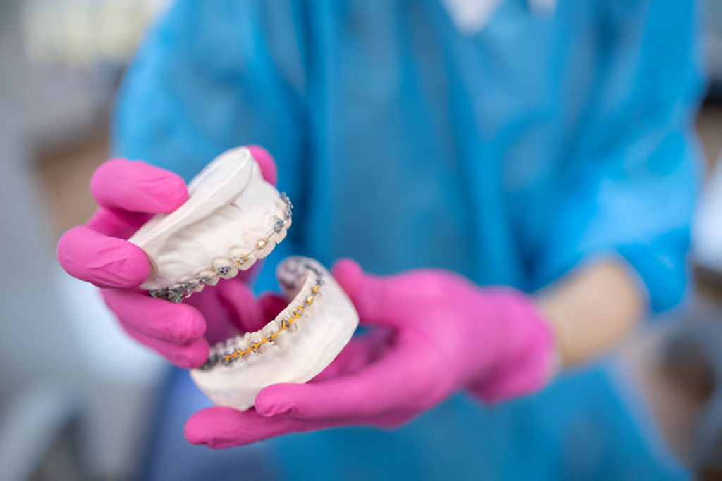 Braces doctor in Mohali